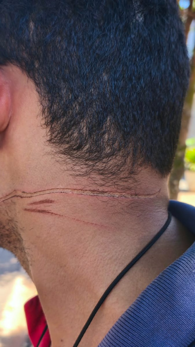 chapadao360: Imagens de câmeras de segurança registraram o momento em que o entregador Edgar se acidentou com um cabo de internet na Avenida Goiás Leste